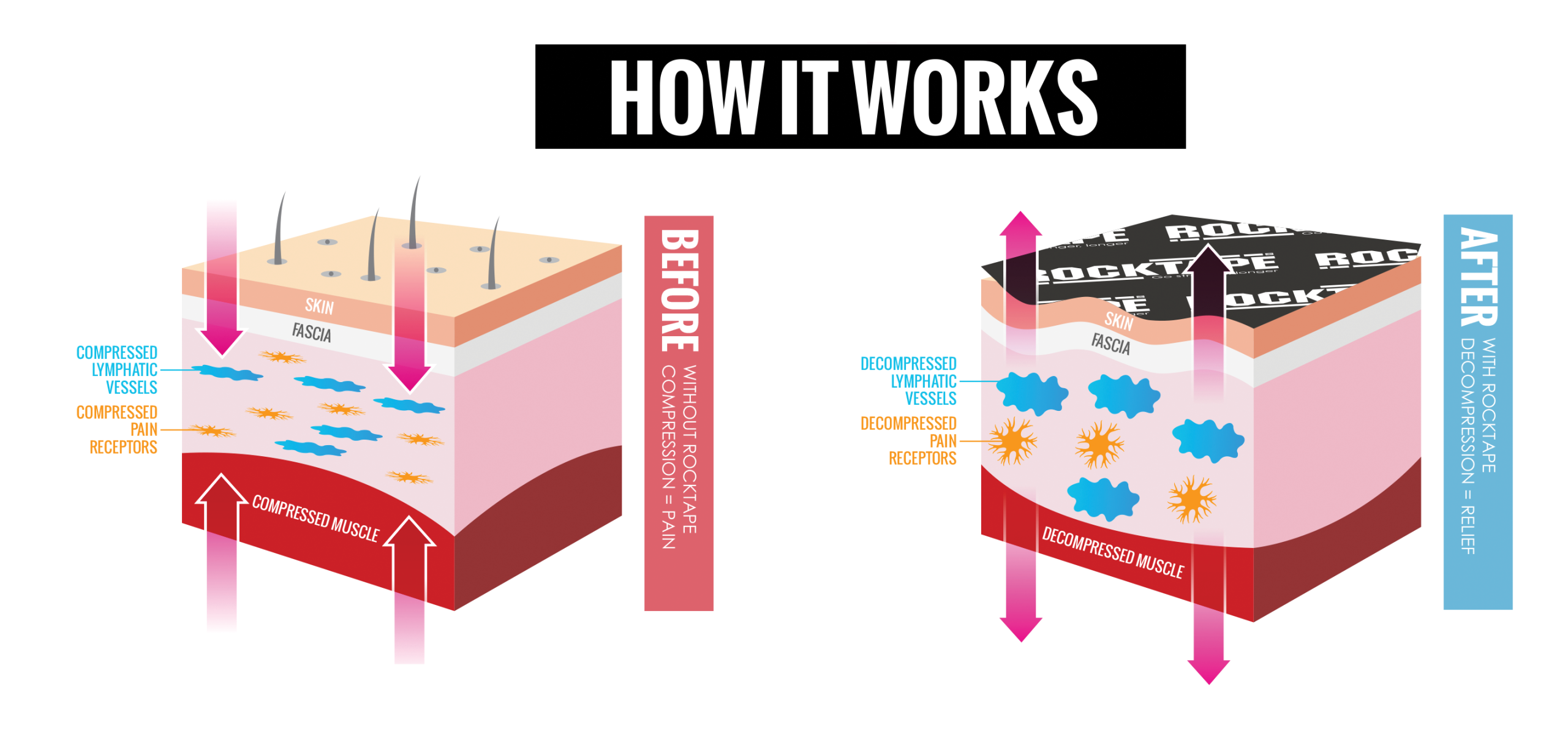 RockTape_Kinesiology_เทปพยุงกล้ามเนื้อ_ลดปวดยังไง